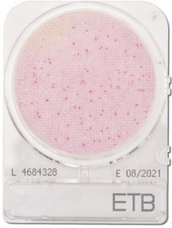 etb